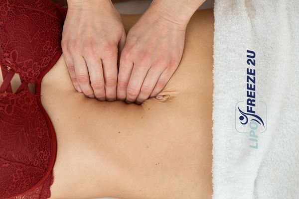 diastasis recti treatment Fleet