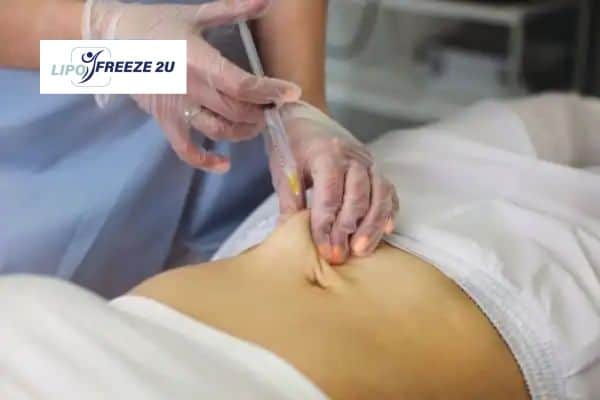 How Does Aqualyx Fat Dissolving Injection Work to Break Down Fat Fleet?