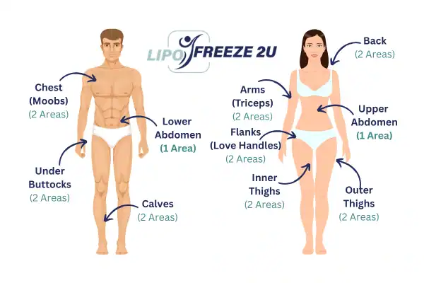 Areas you can have fat freezing treatment Fleet