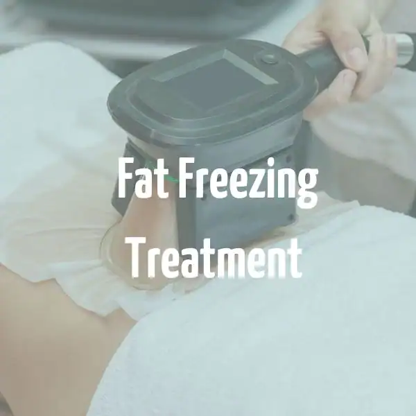 fat freezing treatment Fleet