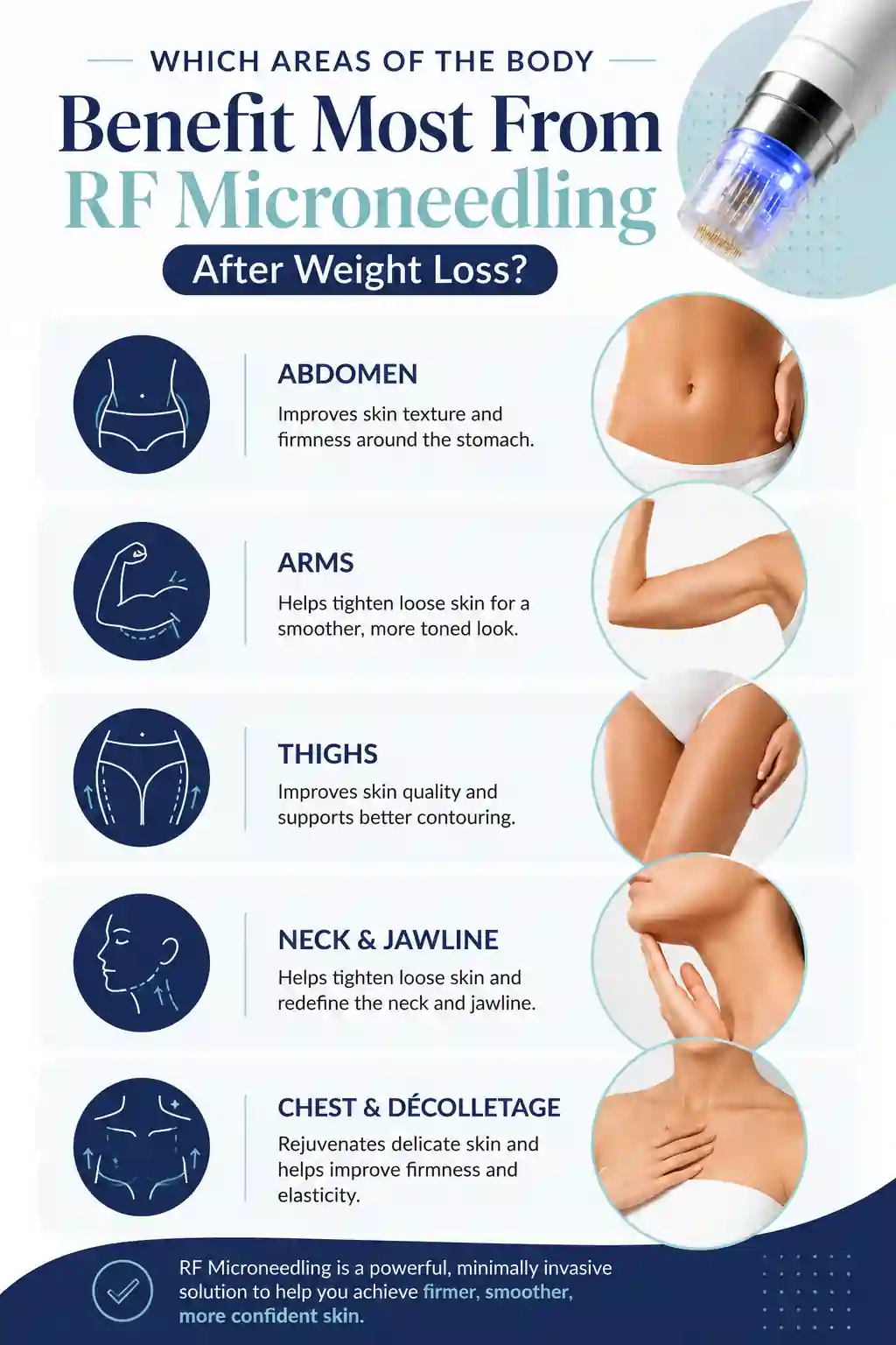 Which Areas of the Body Benefit Most From RF Microneedling After Weight Loss Fleet